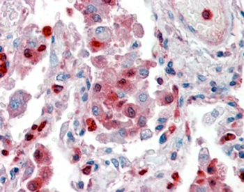 Goat anti-S100A9 Antibody