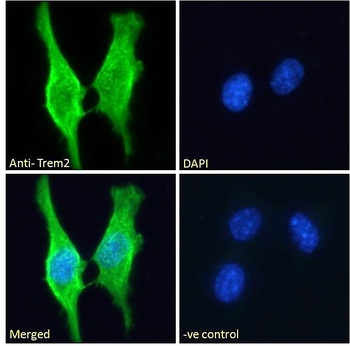 Trem2 antibody