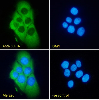 SEPT6 Antibody