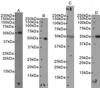 SEPT6 Antibody