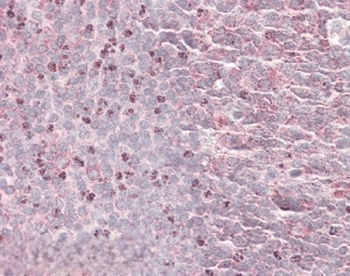 SEPT6 Antibody
