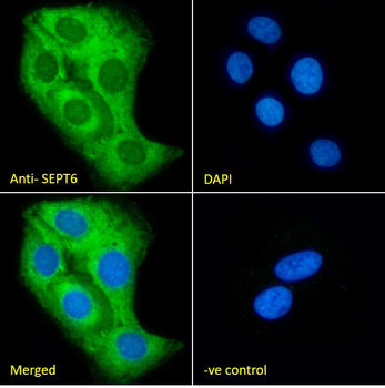 SEPT6 Antibody