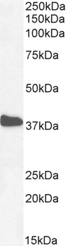 CSX1/NKX2-5 Antibody