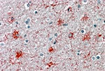Goat anti-P2RX7 / P2X7 receptor Antibody