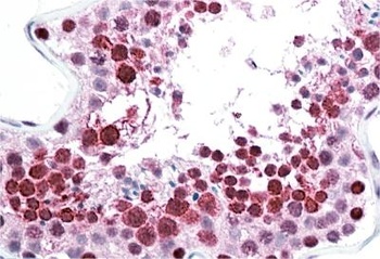 Goat anti-HSPC117 (aa201-215) Antibody