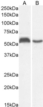 Goat anti-HSPC117 (aa201-215) Antibody
