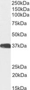 Positive Control Lysate for anti- GAPDH antibody