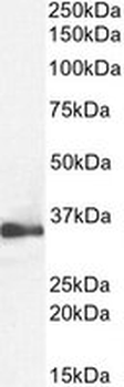 Positive Control Lysate for anti- GAPDH antibody