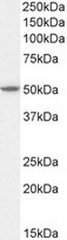 Positive Control Lysate for anti- AKT3 antibody