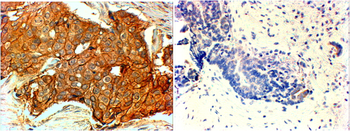 ERBB2/HER2 Antibody