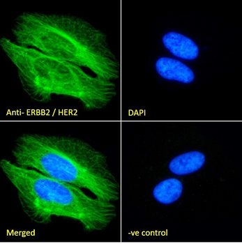 ERBB2/HER2 Antibody