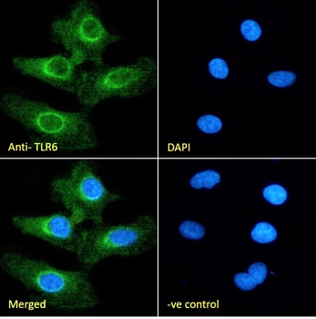 Goat Anti-TLR6 Antibody