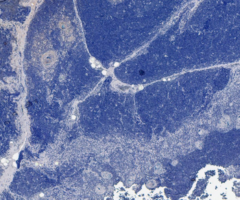 Goat Anti-CCR2 Antibody