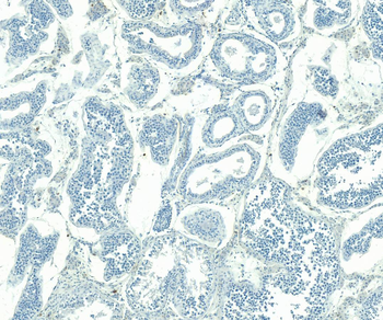 Goat ABCG1 Antibody
