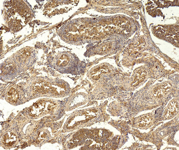 Goat ABCG1 Antibody