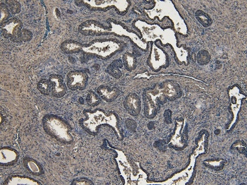 Goat anti-ROR1 Antibody