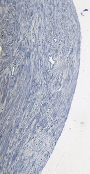 ROR1 Antibody