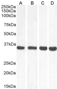 MDH2