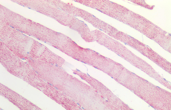 MDH2