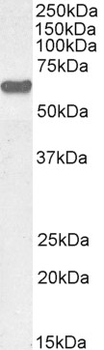 AKT1 Antibody