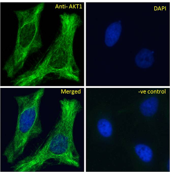 AKT1 Antibody