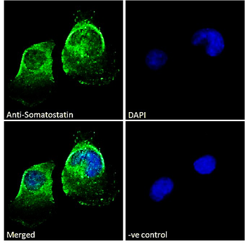 Somatostatin proprotein (aa58-70)