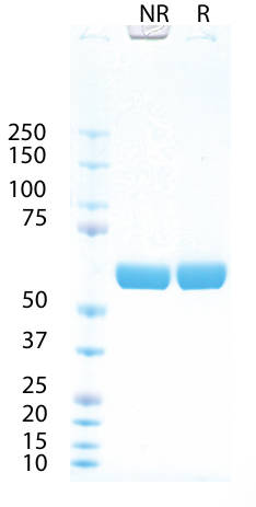 AVS Bio - Alkaline Phosphatase, Placenta, Human, Secreted (Mannitol Buffer)