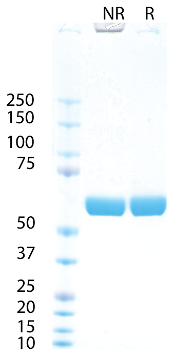 AVS Bio - Alkaline Phosphatase, Placenta, Human, Secreted (Mannitol Buffer)