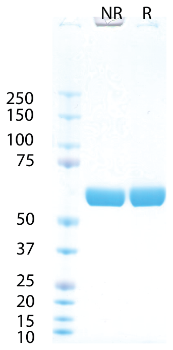 AVS Bio - Alkaline Phosphatase, Placenta, Human, Secreted (Mannitol Buffer)