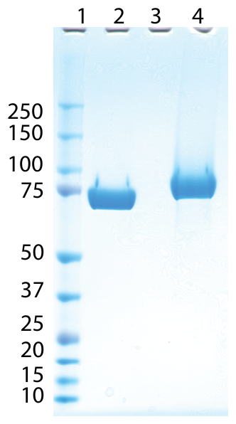 AVS Bio - Complement Factor B, Human, Man5-Glcnac2 N-Linked Glycans