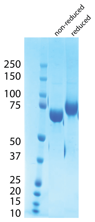 AVS Bio - C1QR-(His)N, Human, Recombinant