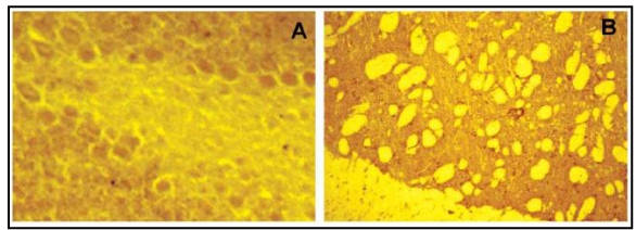 AVS Bio - mouse anti-receptor-type tyrosine-protein phosphatase R isoforms antibody