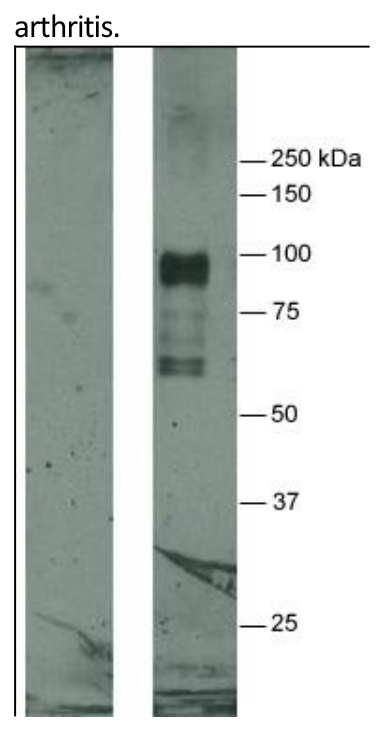 AVS Bio - human citrullinated fibrinogen antibody