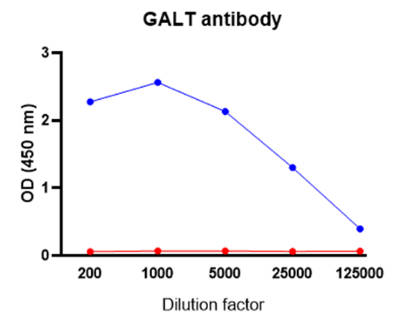 AVS Bio - human galactose-1-phosphate uridylyltransferase antibody