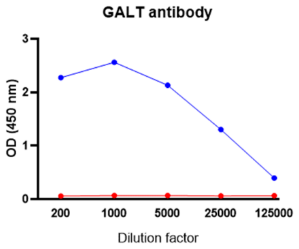 AVS Bio - human galactose-1-phosphate uridylyltransferase antibody