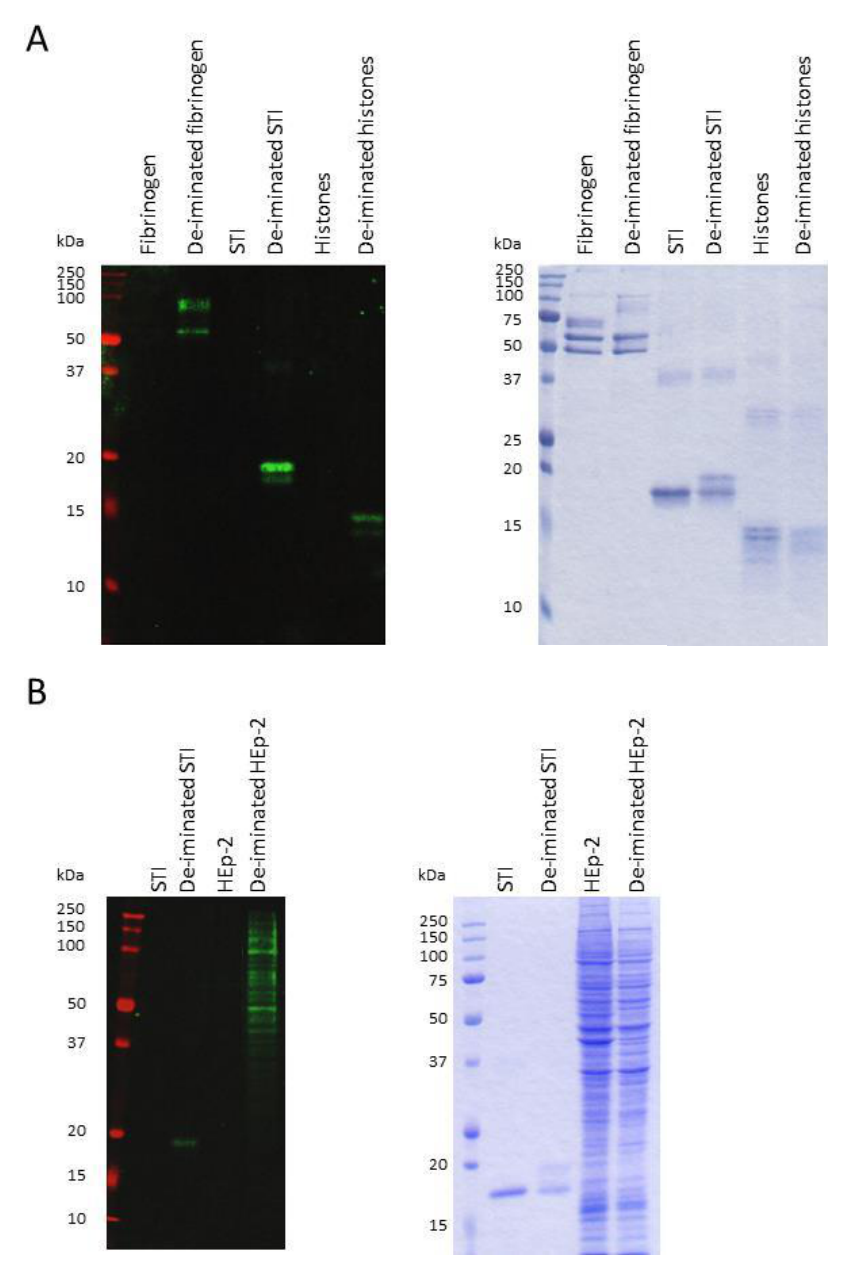 AVS Bio - human modified citrulline antibody