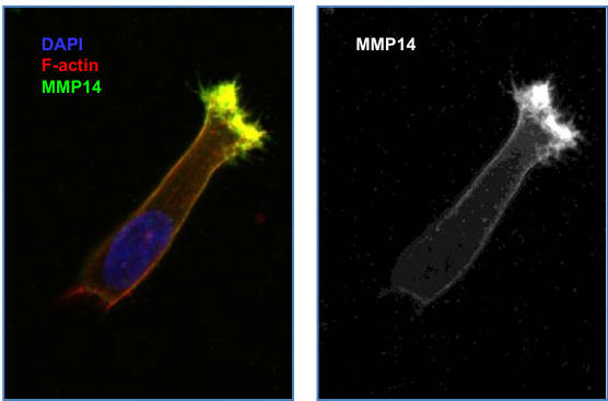 AVS Bio - human anti-matrix metallopeptidase-14 antibody