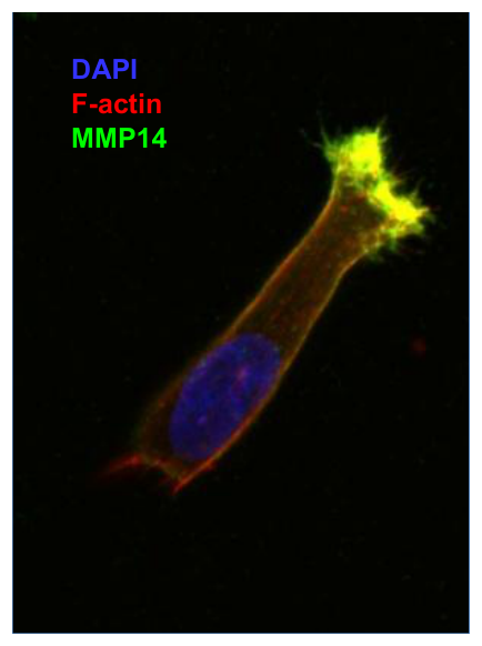 AVS Bio - human matrix metallopeptidase-14 antibody
