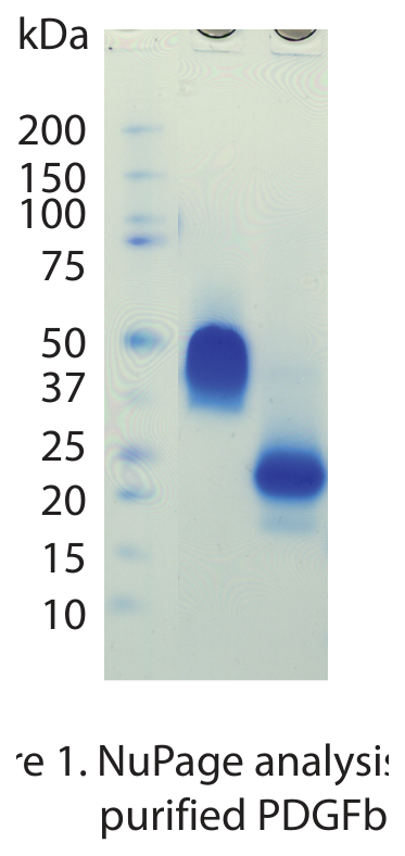 AVS Bio - Platelet Derived Growth Factor Βeta, Human