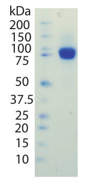AVS Bio - PDGF-R Beta-(His)C, ECD, Human, Recombinant