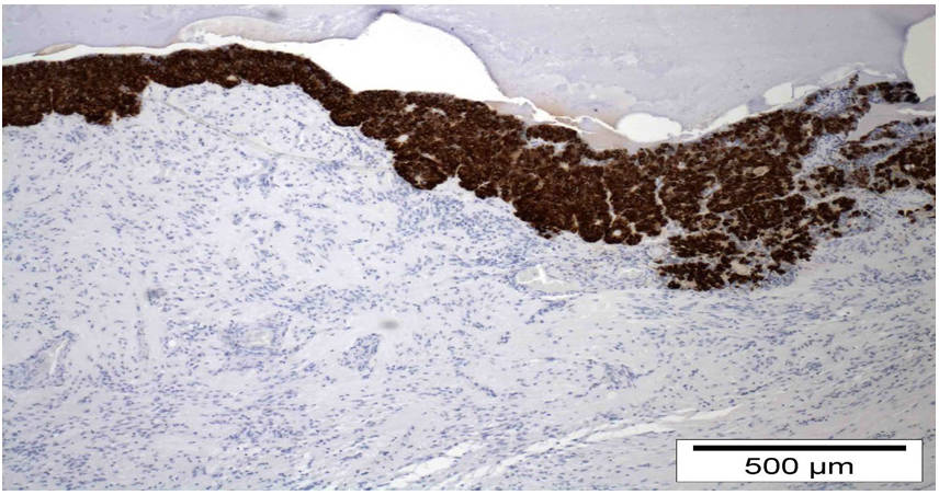 AVS Bio - mouse anti-human ACTH (POMC)