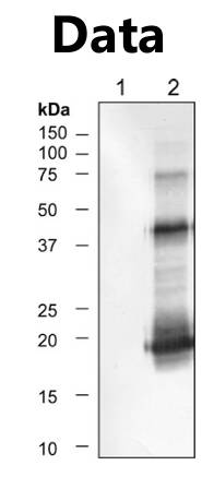 AVS Bio - mouse anti-human Mart-1, IHC on melanoma tissue