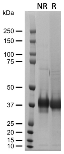 AVS Bio - mRSPO1-his