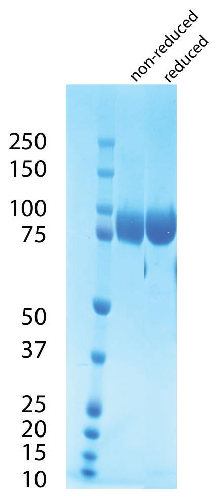 AVS Bio - VCAM1-(His)N, Transcript A, Human, Recombinant
