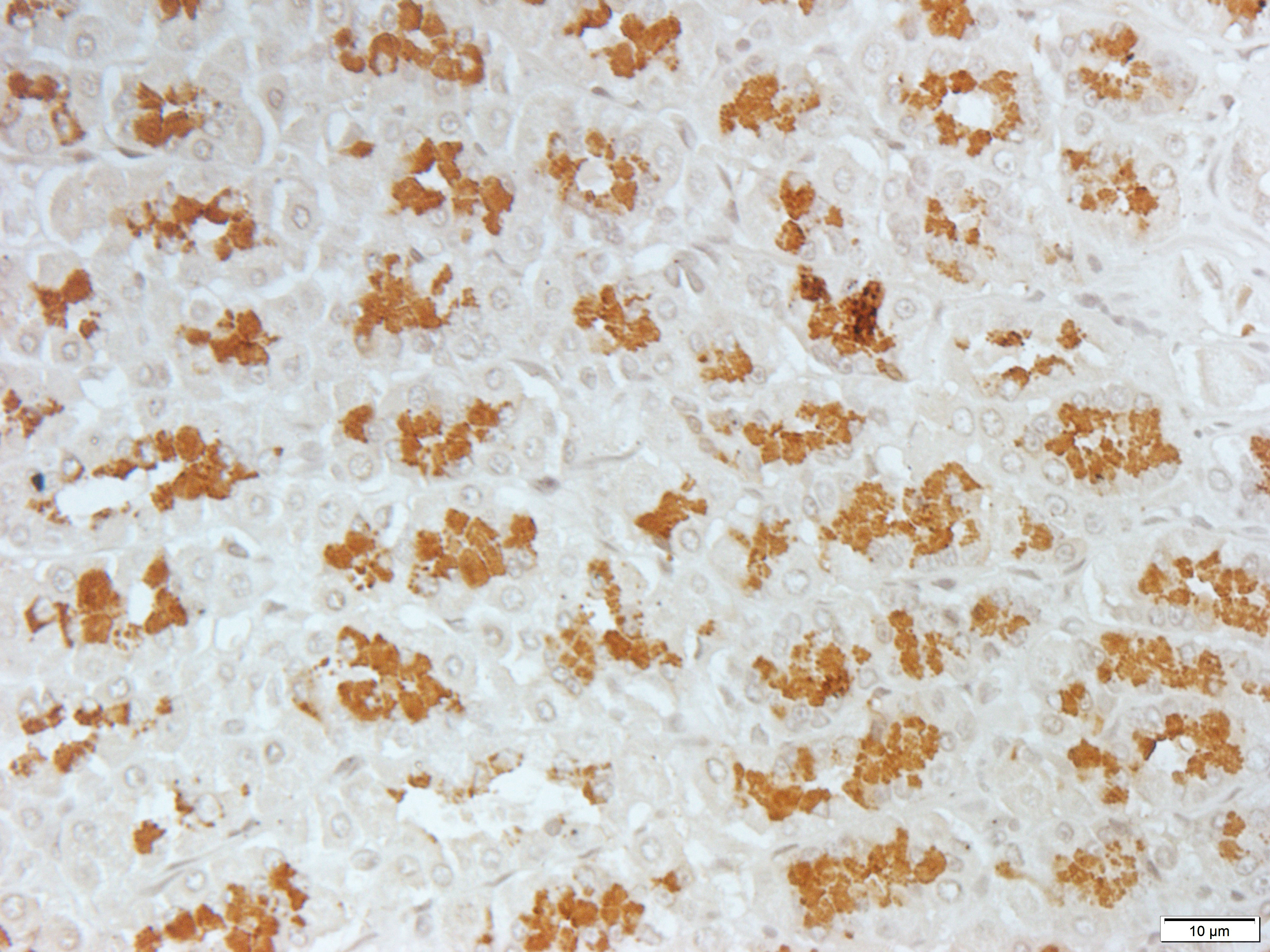 Alpha-actin-3 Rabbit Polyclonal Antibody