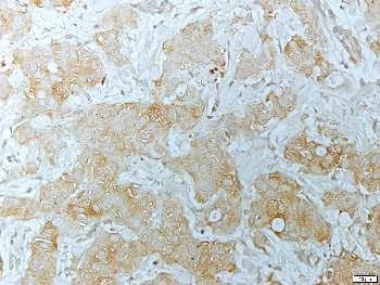 CD95 Rabbit Polyclonal Antibody