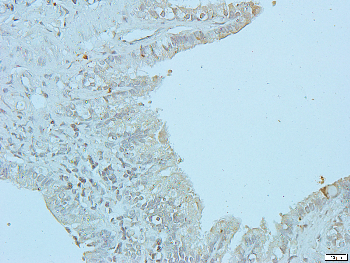CD178 Rabbit Polyclonal Antibody