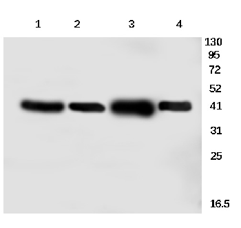 Creatine Kinase M Rabbit Polyclonal Antibody
