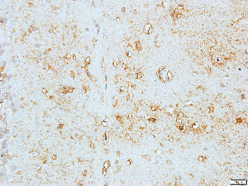 Creatine Kinase M Rabbit Polyclonal Antibody