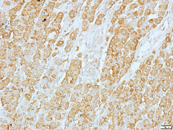 Creatine Kinase M Rabbit Polyclonal Antibody